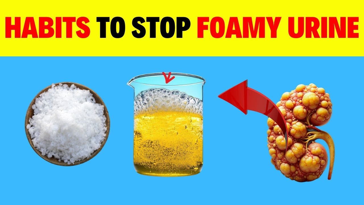 6 Science backed Ways to Help Stop Proteinuria and Heal Your Kidneys ...