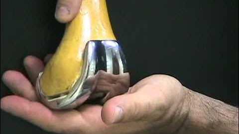 Sawbones Total Knee Replacement