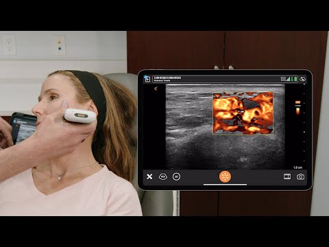 Image of Ultrasound of the Jawline