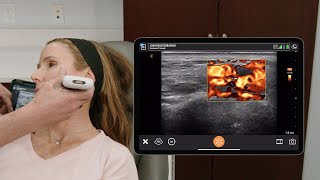 Ultrasound of the Jawline