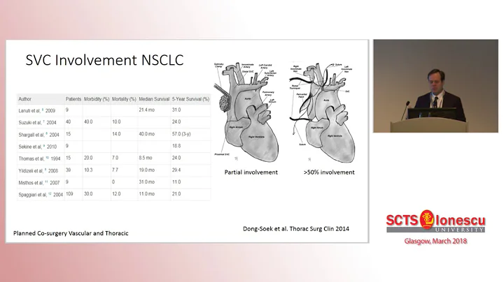 SCTS 2018 - SSurgery with the Vascular Surgeon - D...