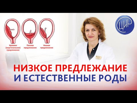 Низкое предлежание плаценты. Возможны ли естественные роды? Дементьева С.Н.