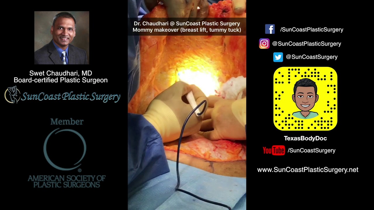 About Suncoast Plastic Surgery In Pearland Tx Suncoast Plastic Surgery