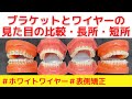 【表側矯正の見た目の比較】各種ブラケットやワイヤーの長所・短所を模型で矯正歯科医が解説