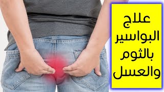 هل يمكن فعلًا علاج البواسير بالثوم والعسل ؟ طريقة عمل خلطة الثوم والعسل للبواسير ( سؤال 150 ) screenshot 1