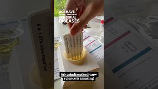 STI Test Part 2/3… did you know?