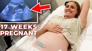 17 WEEK ULTRASOUND! How Does This Keep Happening? 😫