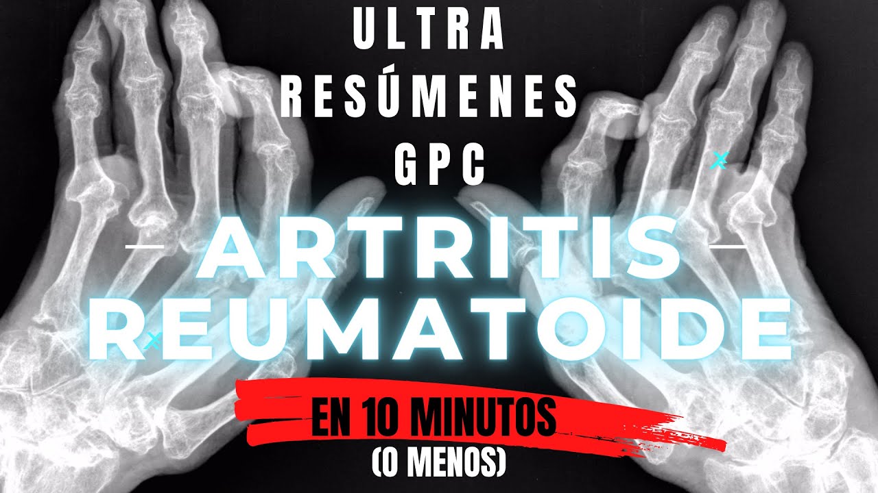 Guia De Practica Clinica Artritis Reumatoide www.youtube.com
