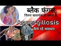 ब्लैक फंगस, जितना खतरनाक हो सकता है Aspergillosis,कोरोना में 4th वायरस का हमला। White Whiz AJ