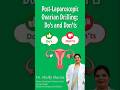 Post Laparoscopic Ovarian Drilling Do's & Dont's
