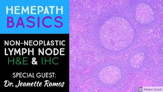 Hemepath Basics: Non-Neoplastic Lymph Node Histology & Immunostains with Dr. Jeanette Ramos