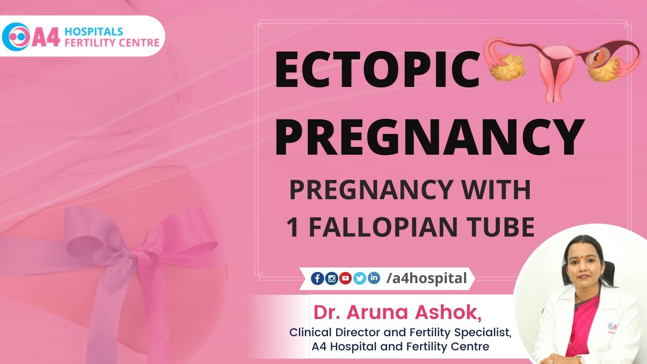 Pregnancy with 1 Fallopian Tube | Ectopic Pregnancy in Tamil |  Risk and Treatment of Ectopic Tamil