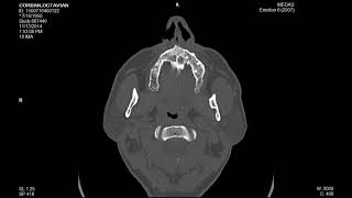 Ct Sinusuri Corban G.