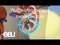 Ударно-волновая литотрипсия (EAU - SWL RU)