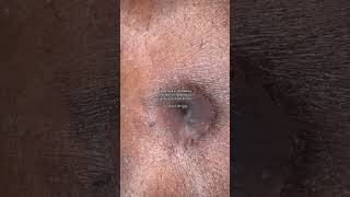 Closer look healing belly button — proof that progress doesn’t always look pretty, it’s happening.
