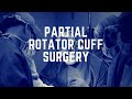 Partial Rotator Cuff Surgery: Inside the Operating Room