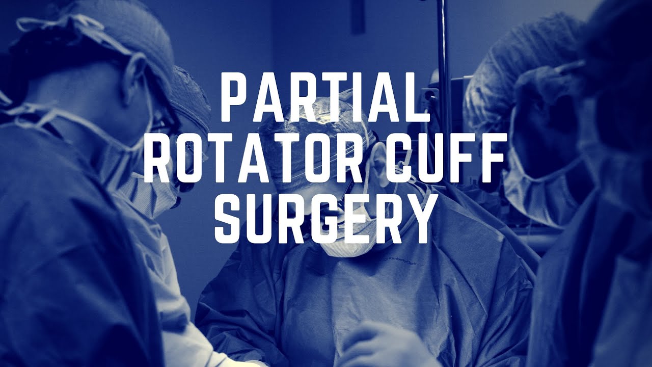 Partial Rotator Cuff Surgery Inside the Operating Room YouTube
