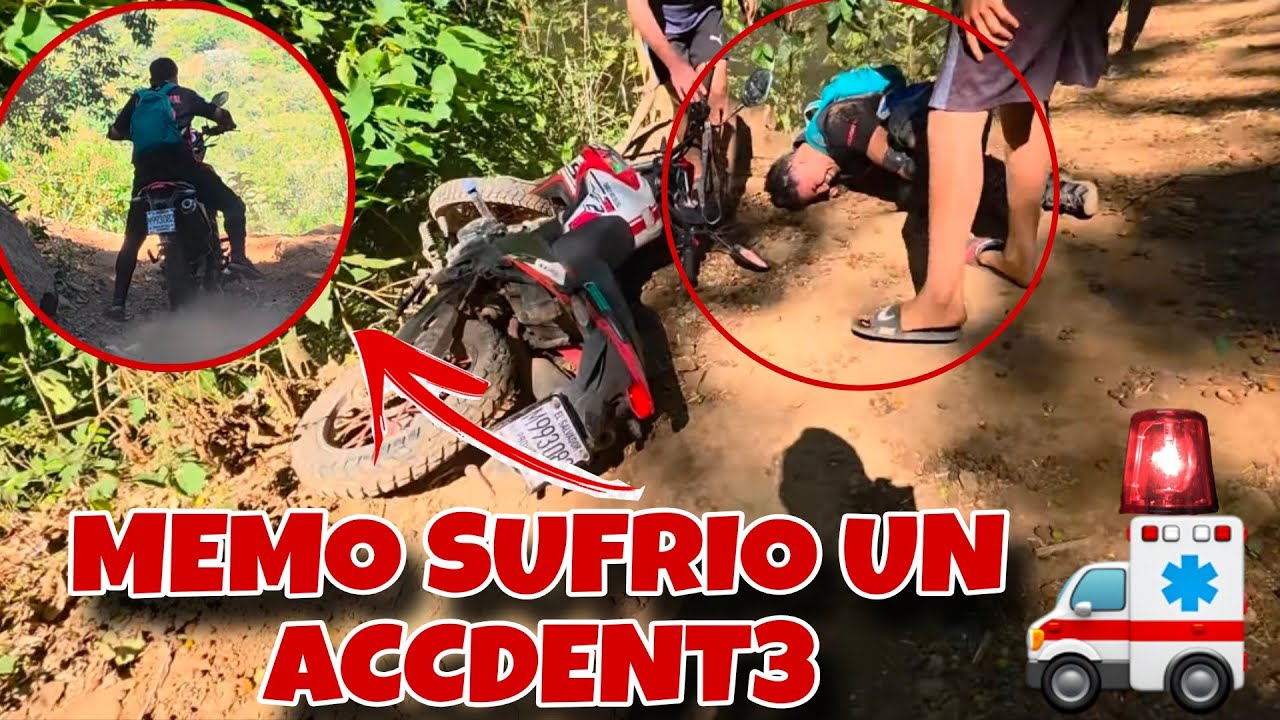 Miren la Caida que tubo MEMO 😱❤️🤯 LE paso Algo ??🤯❤️😱