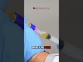 Platelet-Rich Plasma (PRP): A Natural Option for Joint Pain Relief