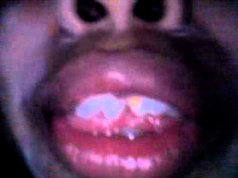 780 Hantu Gigi Terbaik