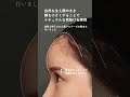 【術後1ヶ月 / #額縮小 プロテーゼ除去】🔻解説はキャプションをチェック👀　#shorts