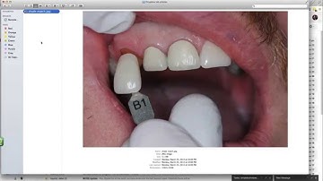 Using Dropbox to send photos to the lab