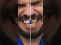 Quick & Easy Teeth Whitening in Photoshop! 🔥🤩 #shorts