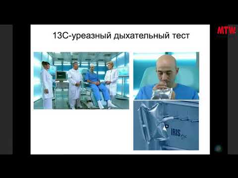 Атрофия слизистой оболочки желудка. Мнение гастроэнтеролога.