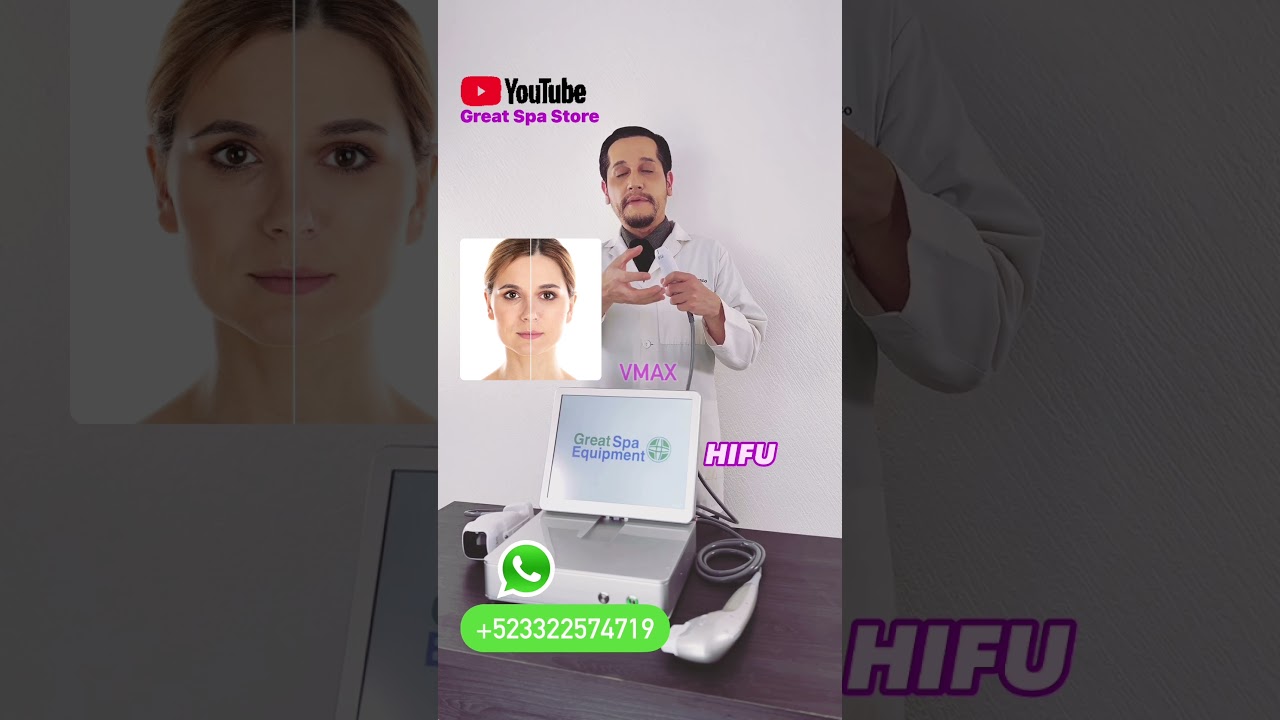 VMAX para lifting facial 