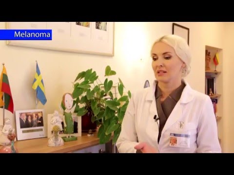 Melanoma gydymas ir profilaktika