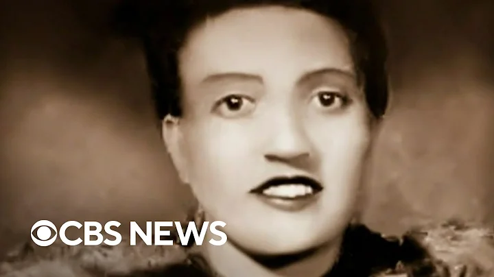Henrietta Lacks' family settles lawsuit after cells used for countless medical breakthroughs