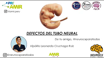 ¿Puede un análisis de sangre detectar defectos del tubo neural?