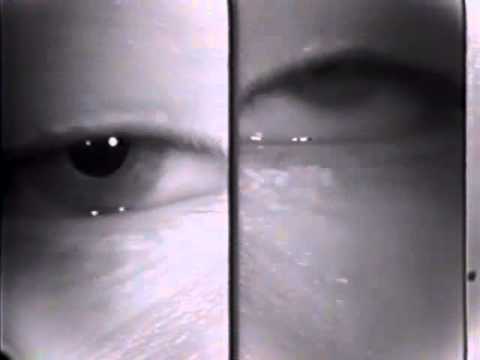 Ocular Myasthenia - Tensilon Test