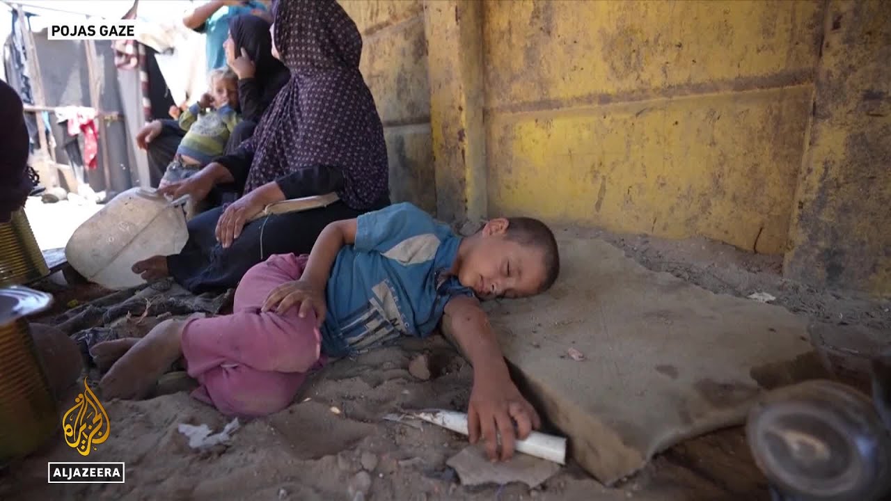 ازداد سوء التغذية بين الأطفال في شمال غزة بنسبة 300 بالمائة