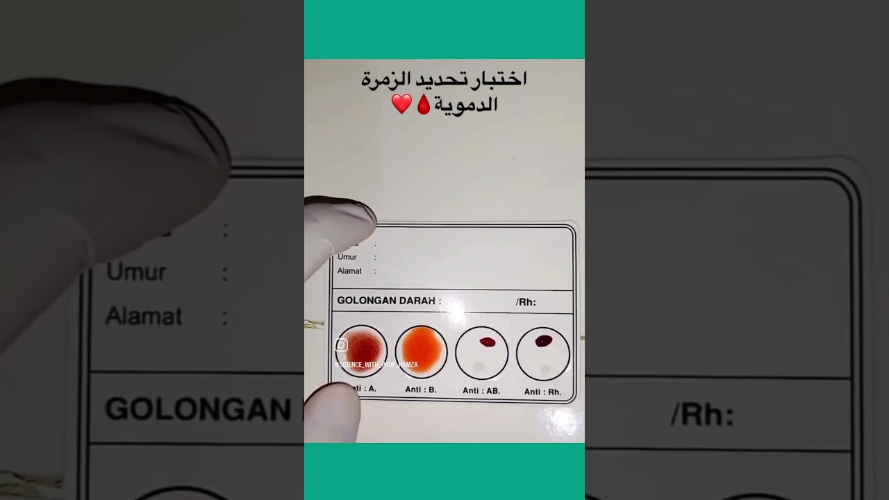 أكتب نوع الزمرة الدموية!!