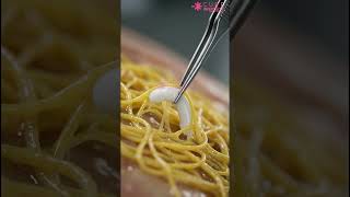 Zero Sperm? घबराएं नहीं! Micro-TESE से अब पिता बनना हुआ आसान | Dr. Rashmi Agrawal #shorts