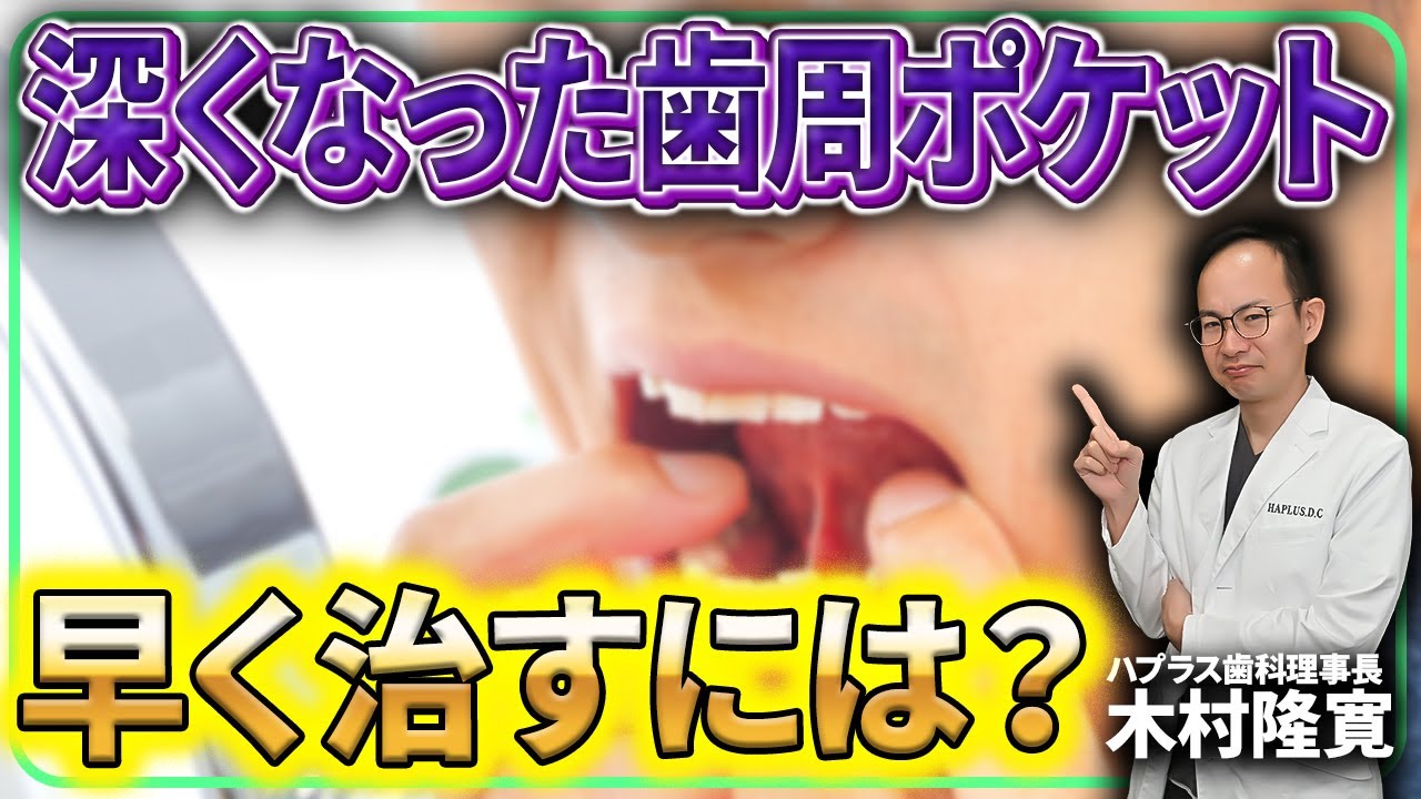 歯周ポケットを浅くしたい場合どうすればいいのか？歯周ポケットの深さについて今回はご紹介させていただきます