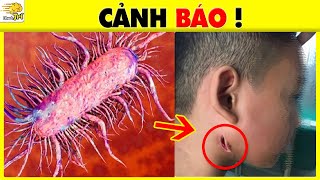 ĐỐ BIẾT 11 Loại Ký Sinh Trùng Gây Hại Cho Vật Chủ - Hãy Tránh Xa Con Thứ 10 | Nhanh Trí