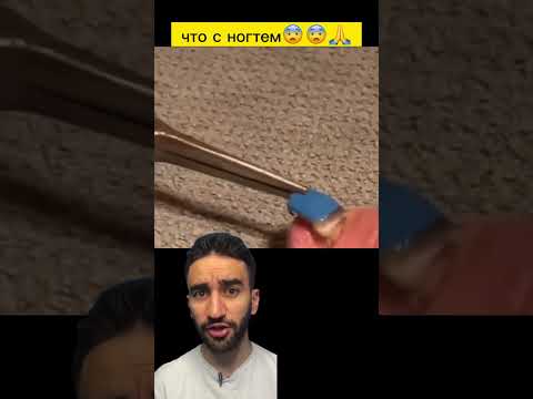 боже мой, что с ногтем?