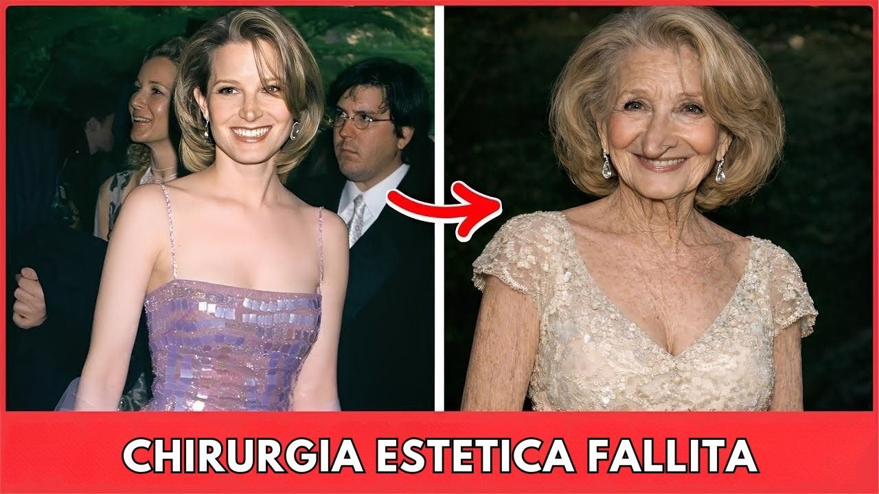 7 attrici di Hollywood un tempo bellissime rovinate dalla chirurgia estetica