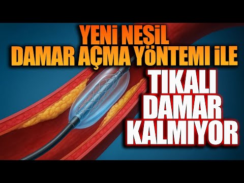 Yeni Nesil damar Açma Yöntemi İle Tıkalı Damar Kalmıyor