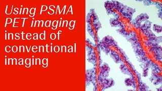 How One APP Stays up to Date on the Latest Prostate Cancer Guidelines screenshot 3