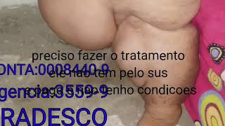 Tenho Linfedema