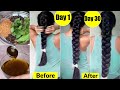 मोटी चोटी Challenge-Winter Fastest Hair Growth Oil-To Grow Hair Faster Naturally-Oil for Hair Loss