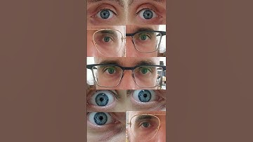 Have We Ever All BLINKED At The Same Time?