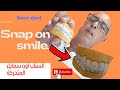 Snap on smile     prparation   noureddinevlogsbr