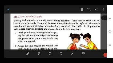 Class 5 science chapter 6 safety and first aid.  Sprains and fracture s