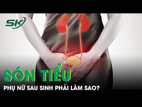 Video: Làm thế nào để đối phó với hội chứng kiểm soát sau sinh