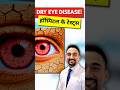 3 Essential Tools Every Eye Clinic Needs for ACCURATE Dry Eye Diagnosis