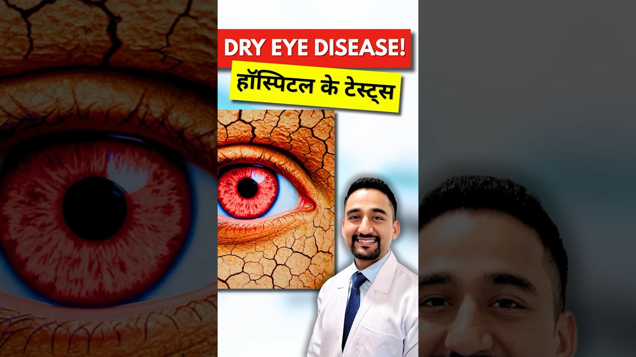 3 Essential Tools Every Eye Clinic Needs for ACCURATE Dry Eye Diagnosis